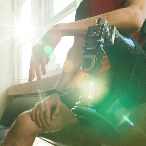 Letselschade bij amputatie